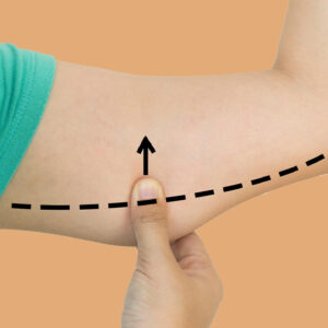 شد الذراعين